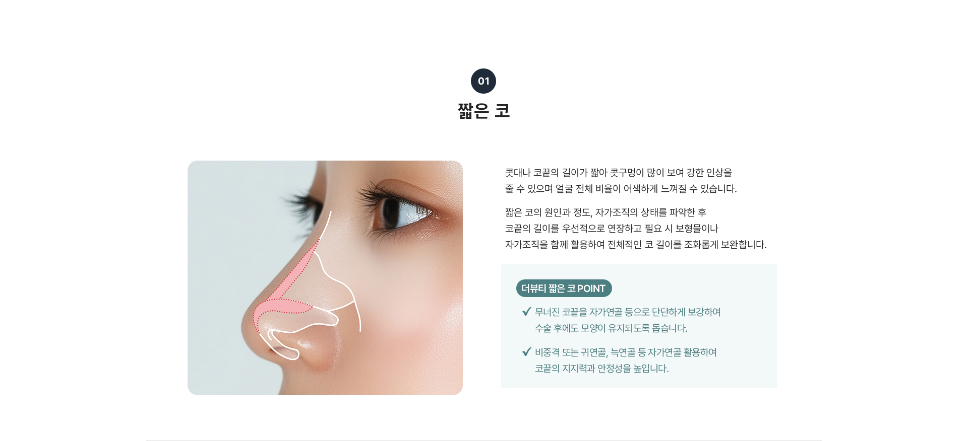코교정 상세05