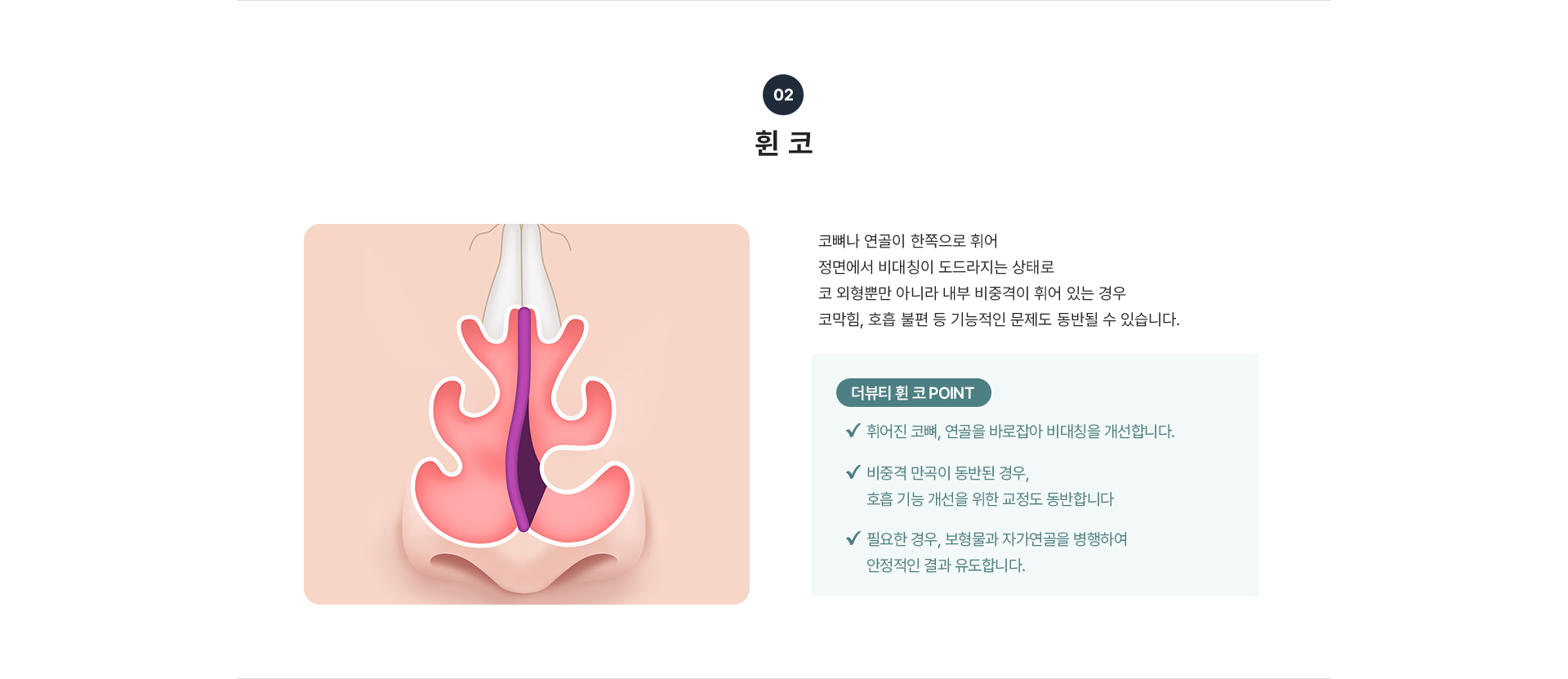 코교정 상세06