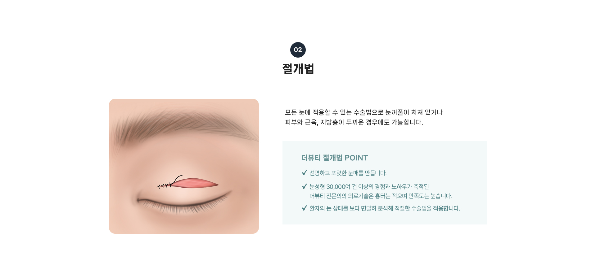 쌍꺼풀 상세06
