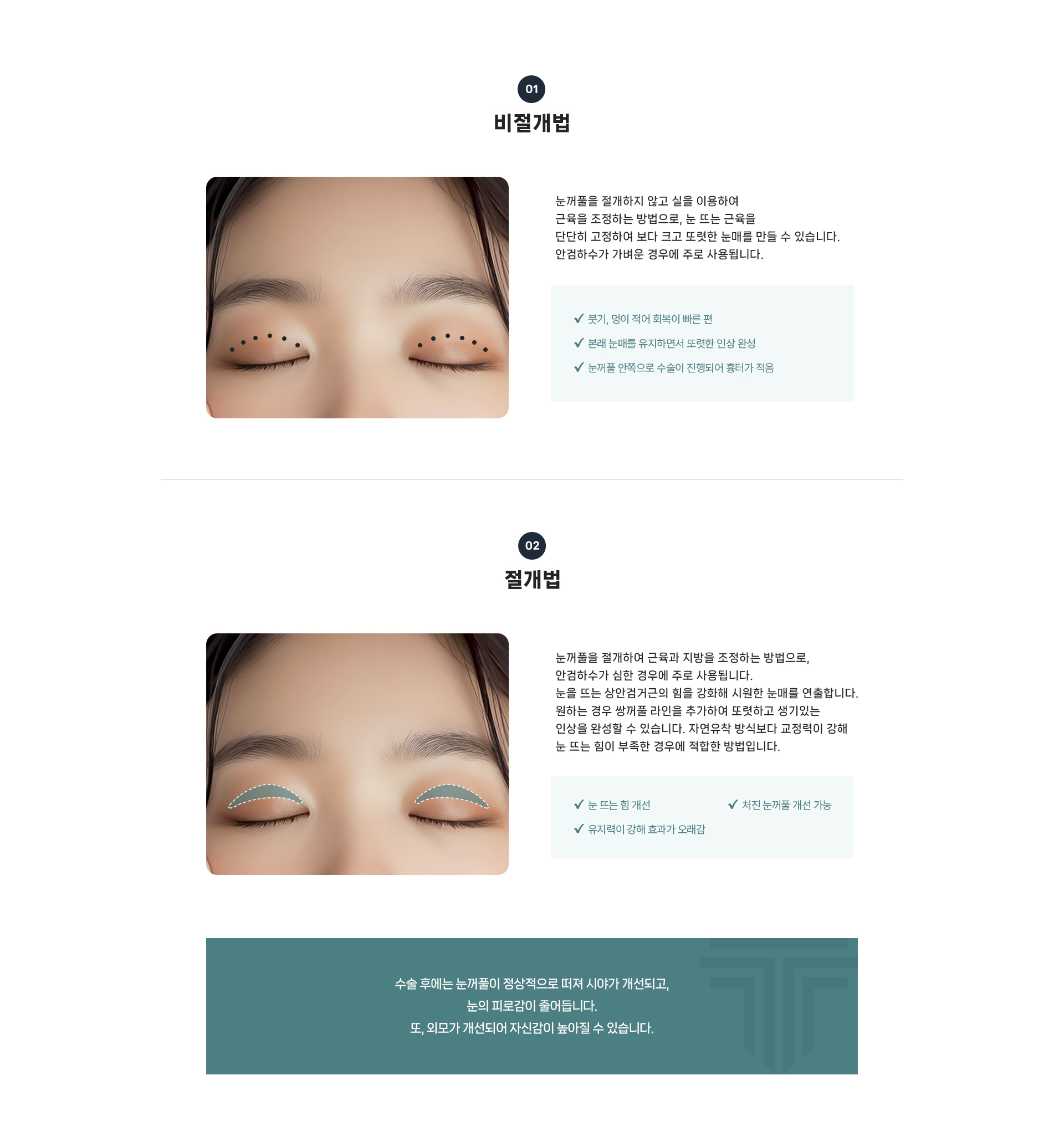 눈매교정 상세07