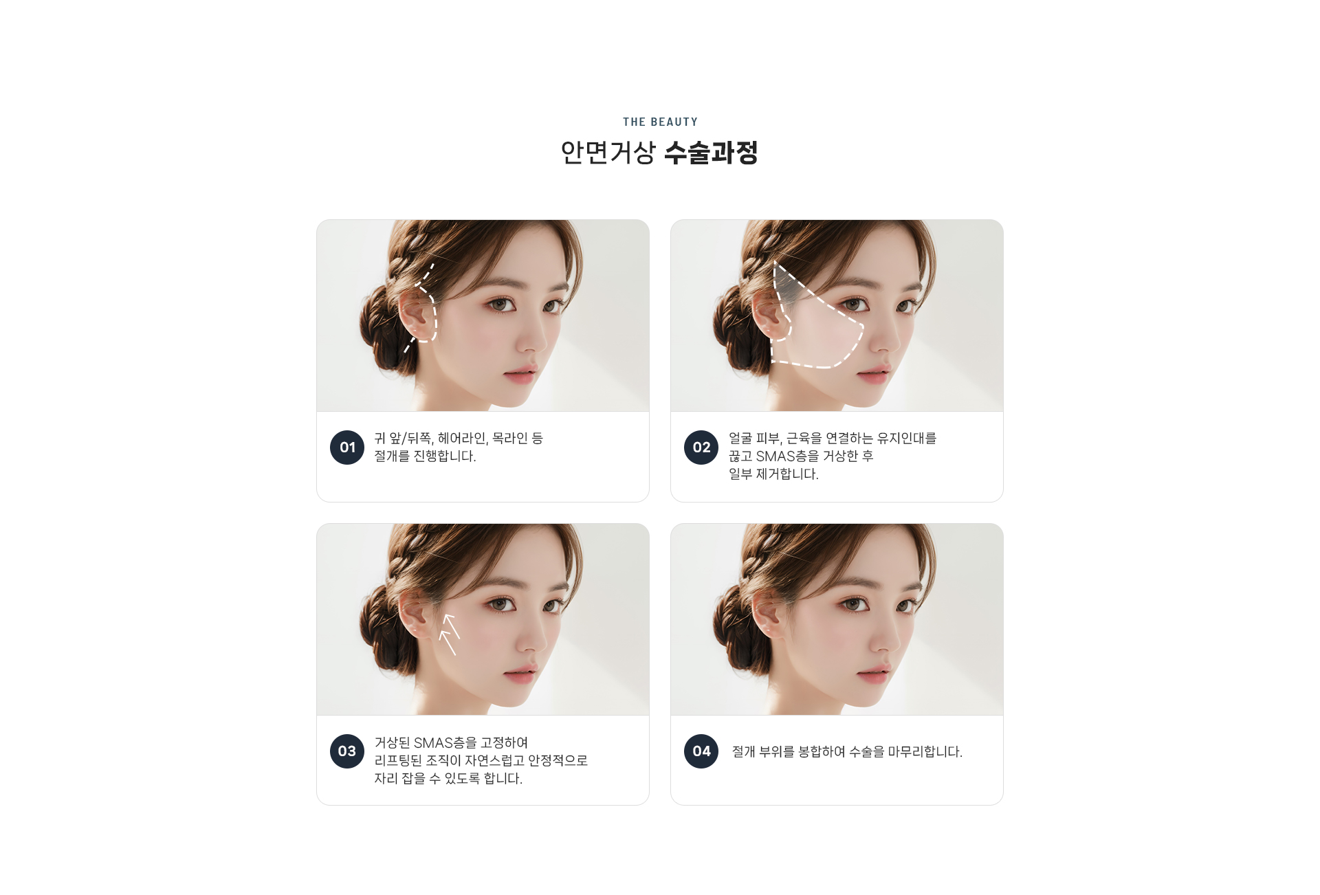 안면거상 상세06