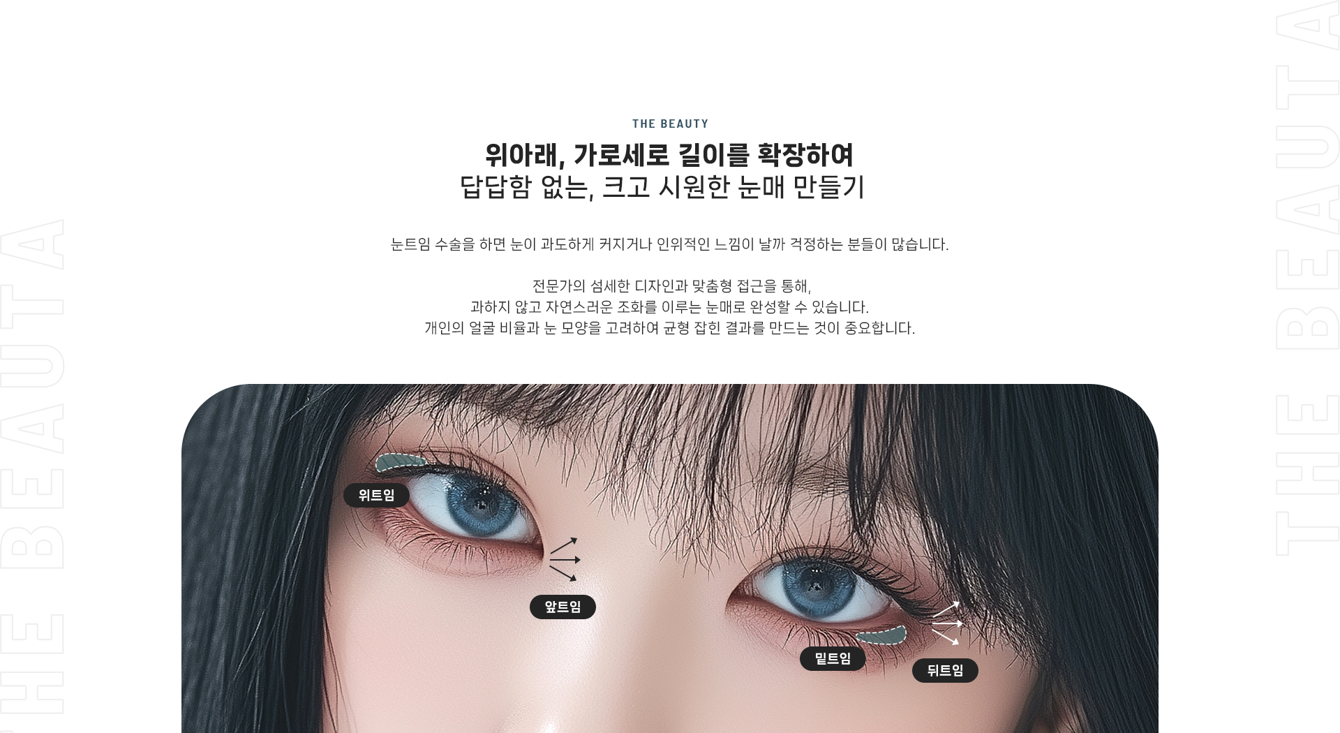트임 상세02